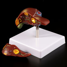 Load image into Gallery viewer, Medical props model Human Liver Pathological Anatomical Model Anatomy School Medical Teaching Display Tool Lab Equipment
