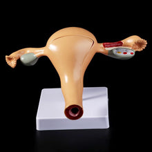 Load image into Gallery viewer, Medical props model Human Pathological Uterus Ovary Model Anatomical Anatomy Disease Pathology Medical Lesion For Teaching
