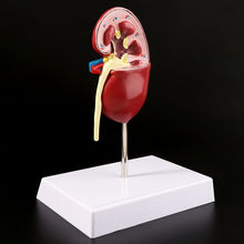 Load image into Gallery viewer, Medical props model Life Size Human Kidney Diseased Model Anatomical Anatomy Diseased Pathological Stone Organ Teaching Supplies
