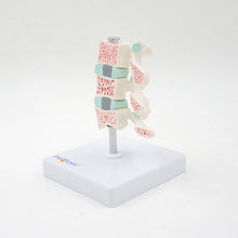 Load image into Gallery viewer, Human Body Model Bone Osteoporosis Lesion Model Spine Cervical Vertebra Displane Model Joint Model Bone Model
