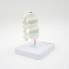 Load image into Gallery viewer, Human Body Model Bone Osteoporosis Lesion Model Spine Cervical Vertebra Displane Model Joint Model Bone Model
