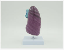 Load image into Gallery viewer, Human Pathological Lung Model Simulation Smokers Lung Internal Organs Specimen Thoracic Surgery Respiratory Department Teaching Aids

