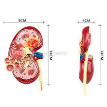 Load image into Gallery viewer, Organ Medical Kidney Anatomical Model Lesion Kidney Model Human Anatomy Teaching Supplies
