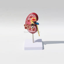Load image into Gallery viewer, Organ Medical Kidney Anatomical Model Lesion Kidney Model Human Anatomy Teaching Supplies
