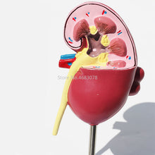 Load image into Gallery viewer, Organ Medical Kidney Anatomical Model Lesion Kidney Model Human Anatomy Teaching Supplies
