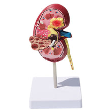 Load image into Gallery viewer, Organ Medical Kidney Anatomical Model Lesion Kidney Model Human Anatomy Teaching Supplies
