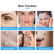 Load image into Gallery viewer, Ozone Plasma Pen Wart Freckle Removal Fibroblast Pen Skin Mole Dark Spot Remover Face Lifting Dot Wrinkle Eyelid Lift
