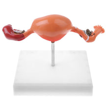 Load image into Gallery viewer, Pathological Uterus and Ovary Anatomical Model - Human Female Medical Anatomy
