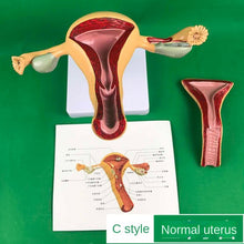 Load image into Gallery viewer, Ovary and uterus disease Dissection model Pathology Female uterus model teaching human medical aids anatomy lesion uterus
