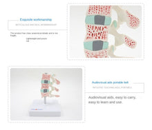 Load image into Gallery viewer, Human Body Model Bone Osteoporosis Lesion Model Spine Cervical Vertebra Displane Model Joint Model Bone Model
