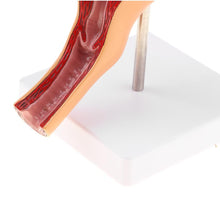 Load image into Gallery viewer, Sexual Female Organ Models Anatomic Model of Female Reproductive Organ Uterus Vagina, Female Womb Model

