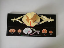 Load image into Gallery viewer, Spinal Cord Nerve Anatomical Model 5 Times Sumal Ventral Dorsal Coccygeal Root  Teaching Resources
