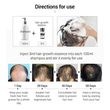 Load image into Gallery viewer, Hair Growth Oil Hair Care Essential Oil Export
