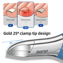 Load image into Gallery viewer, Nail Clippers Professional Stainless Steel Olecranon Pliers Anti-Splash Ingrown Paronychia Manicure Tools Hand Foot Care

