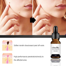 Load image into Gallery viewer, Mole Removal Wart Essence Skin Removal Facial Armpit Flesh Bump Repair Cleaning Care
