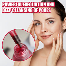 Load image into Gallery viewer, Tartaric Acid Salicylic Acid Essence Exfoliating Closed Blackhead Acne Pore Shrinking Essence
