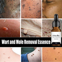 Load image into Gallery viewer, Mole Removal Wart Essence Skin Removal Facial Armpit Flesh Bump Repair Cleaning Care
