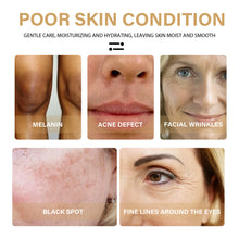 Load image into Gallery viewer, Turmeric Essence Removing Dark Spot Repair Anti-Aging Fading Wrinkle Wrinkle Skin Moisturizing and Nourishing Essence
