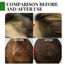 Load image into Gallery viewer, Rosemary Hair Essential Oil Nourishing Repair Improve Split Hair Care Eliminate Itching Dry Scalp
